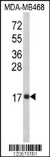 Anti-IL8 Rabbit Polyclonal Antibody