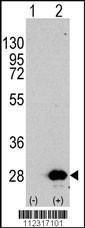 Anti-HSPB1 Rabbit Polyclonal Antibody (APC (Allophycocyanin))