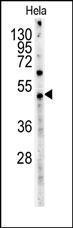 Anti-Myc Tag Mouse Monoclonal Antibody [clone: 9E10]