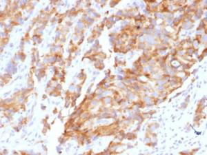 Anti-Aurora B Mouse Monoclonal Antibody [clone: AURKB/1592]