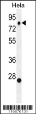 Anti-SSH3 Rabbit Polyclonal Antibody