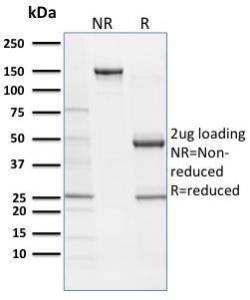 SDS-PAGE analysis of Anti-SOX9 Antibody [SOX9/2387] under non-reduced and reduced conditions; showing intact IgG and intact heavy and light chains, respectively. SDS-PAGE analysis confirms the integrity and purity of the antibody