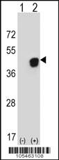 Anti-PGK1 Rabbit Polyclonal Antibody