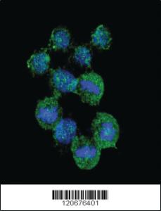 Anti-IL8 Rabbit Polyclonal Antibody