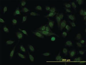 Anti-STAG1 Mouse Monoclonal Antibody [clone: 2E9]