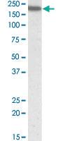 Anti-ITGAL Goat Polyclonal Antibody