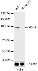 Western blot analysis of extracts from wild type(WT) and MSH2 Rabbit polyclonal antibody knockout (KO) HeLa cells, using Anti-MSH2 Antibody (A307086) at 1:1,000 dilution