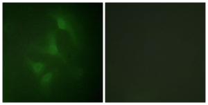 Immunofluorescence analysis of HeLa cells using Anti-JNK1 + JNK2 + JNK3 Antibody. The right hand panel represents a negative control, where the antibody was pre-incubated with the immunising peptide