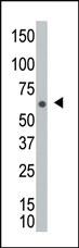 Anti-NEK8 Rabbit Polyclonal Antibody