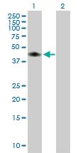 Anti-CA14 Mouse Polyclonal Antibody