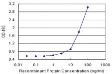 Anti-TNFSF13B Antibody Pair