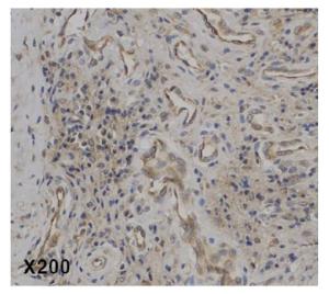 Anti-IL-37 Rabbit Polyclonal Antibody