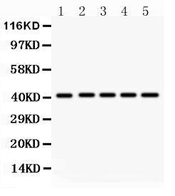 Anti-HOXA10 Polyclonal Antibody