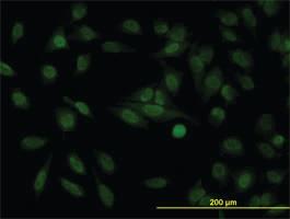 Anti-STAG1 Mouse Monoclonal Antibody [clone: 2E9]