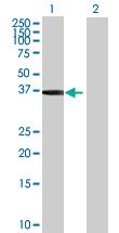 Anti-MAPRE2 Mouse Polyclonal Antibody