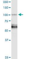 Anti-BRD2 Polyclonal Antibody Pair