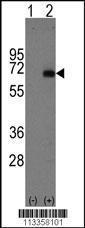 Anti-Fetoprotein Rabbit Polyclonal Antibody