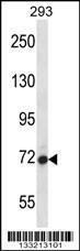 Anti-AGAP4 Rabbit Polyclonal Antibody (Biotin)