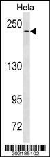 Anti-NOTCH3 Mouse Monoclonal Antibody (PE (Phycoerythrin)) [clone: 487CT6.9.2]