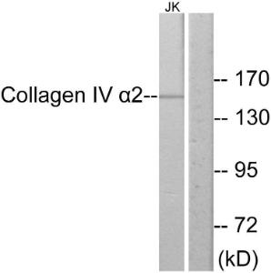 Western blot analysis of lysates from Jurkat cells using Anti-Collagen IV alpha2 Antibody. The right hand lane represents a negative control, where the Antibody is blocked by the immunising peptide