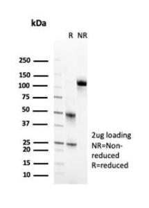 SDS-PAGE analysis of Anti-CD2 Antibody [LFA2/7102] under non-reduced and reduced conditions; showing intact IgG and intact heavy and light chains, respectively. SDS-PAGE analysis confirms the integrity and purity of the antibody