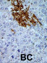 Anti-PNCK Rabbit Polyclonal Antibody