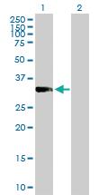 Anti-PRKRA Mouse Polyclonal Antibody