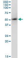 Anti-ARMC6 Mouse Monoclonal Antibody [clone: 2H8]