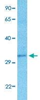 Anti-DBP Rabbit Polyclonal Antibody