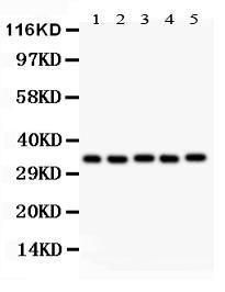 Anti-HOXA11 Polyclonal Antibody