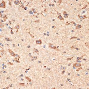 Immunohistochemistry analysis of paraffin-embedded mouse spinal cord using Anti-Bax Antibody (A12539) at a dilution of 1:100 (40X lens). Perform microwave antigen retrieval with 10 mM Tris/EDTA buffer pH 9.0 before commencing with IHC staining protocol