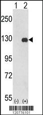 Anti-PTK2 Rabbit Polyclonal Antibody