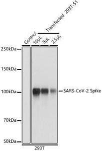 Western blot analysis of extracts of 293T and transfected 293T-S1 (His-tag), using Anti-SARS-CoV-2 Spike Glycoprotein Antibody (A308165) at 1:1,000 dilution. The secondary antibody was Goat Anti-Rabbit IgG H&L Antibody (HRP) at 1:10,000 dilution.