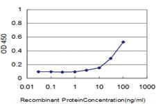 Anti-JAK3 Mouse Monoclonal Antibody [clone: 3F10]