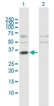 Anti-PRKRA Rabbit Polyclonal Antibody