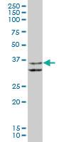 Anti-MAPRE2 Mouse Polyclonal Antibody