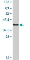 Anti-TSNAX Mouse Monoclonal Antibody [clone: 4D5]