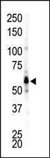 Anti-FGR Rabbit Polyclonal Antibody (AP (Alkaline Phosphatase))