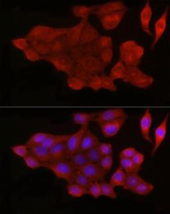 Immunofluorescence analysis of HeLa cells using Anti-Bax Antibody (A12539) at a dilution of 1:50 (40X lens). DAPI was used to stain the cell nuclei (blue)