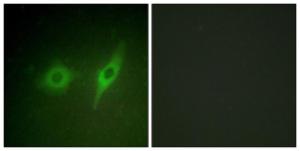 Immunofluorescence analysis of HeLa cells using Anti-Collagen IV alpha2 Antibody. The right hand panel represents a negative control, where the Antibody was pre-incubated with the immunising peptide