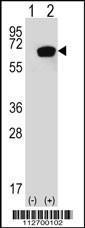 Anti-HSPA1A Rabbit Polyclonal Antibody (AP (Alkaline Phosphatase))