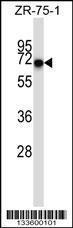 Anti-CD5 Rabbit Polyclonal Antibody (FITC (Fluorescein Isothiocyanate))