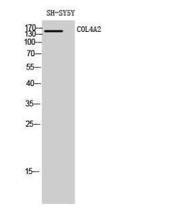 Western blot analysis of SH SY5Y cells using Anti-Collagen IV alpha2 Antibody