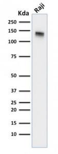 Anti-CD22 antibody