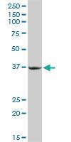 Anti-PRKRA Rabbit Polyclonal Antibody