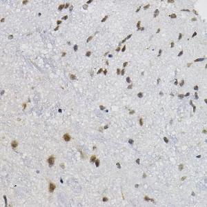 Immunohistochemistry analysis of paraffin-embedded mouse spinal cord using Anti-DNAJC17 Antibody (A307090) at a dilution of 1:20 (40X lens). Perform high pressure antigen retrieval with 10 mM citrate buffer pH 6.0 before commencing with IHC staining protocol