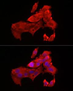 Immunofluorescence analysis of HepG2 cells using Anti-Bax Antibody (A12539) at a dilution of 1:50 (40X lens). DAPI was used to stain the cell nuclei (blue)