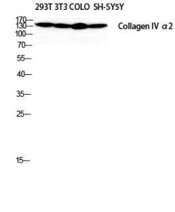 Western blot analysis of SH SY5Y 293T NIH 3T3 COLO cells using Anti-Collagen IV alpha2 Antibody