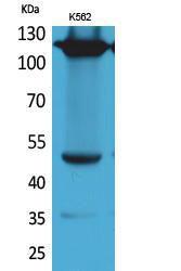 Western blot analysis of K562 cells using Anti-ITGA4 Antibody