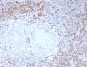 Immunohistochemical analysis of formalin-fixed, paraffin-embedded human tonsil using Anti-CD2 Antibody [LFA2/7102] at 2 µg/ml in PBS for 30 minutes at room temperature